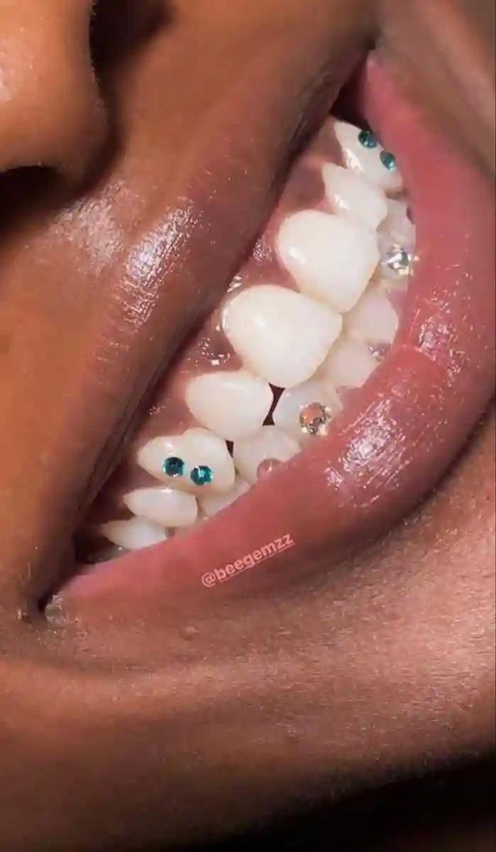 teeth gems 
