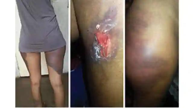 2 Bulawayo Sisters Who Were Assaulted By The Police Identify Alleged Assailants During A Parade