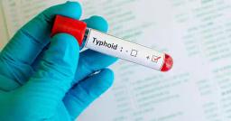 52 000 Vaccinated Against Typhoid