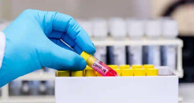 Coronavirus: Mandatory Tests For All Sudden, Home Deaths