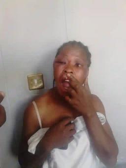 Deputy Minister Calls Battered & Bruised MDC Youth Leader A "Prostitute"