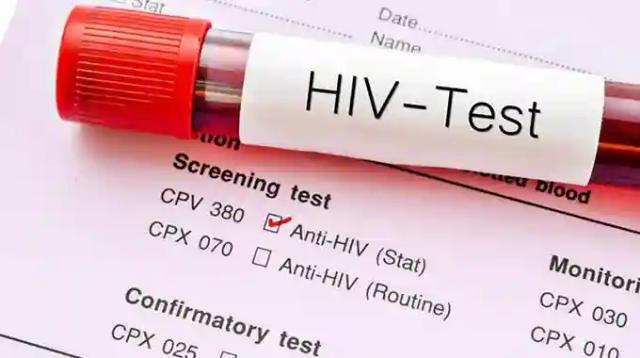 Govt Gazettes Law To Decriminalise HIV Transmission