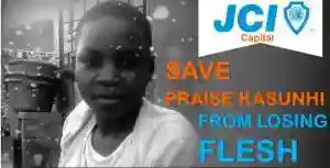 Help Save Praise Kasunhi From Losing Flesh (Graphic images)
