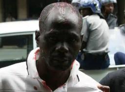 Journalists injured while covering clashes  between  police and  forex dealers