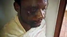 PICTURES: Zimdancehall Artist Abducted, Assaulted