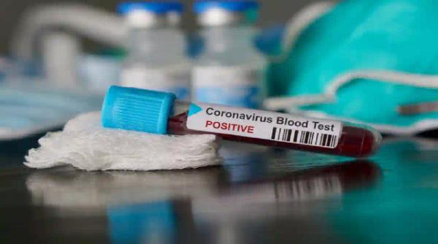 South Africa's Confirmed Coronavirus Cases Soar To 709