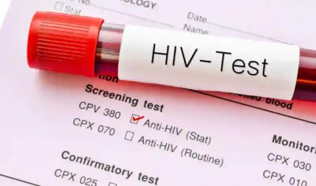 UN Commends Zim For Reducing HIV/AIDS Transmission