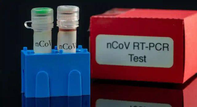 Zimbabwe Running Out Of COVID-19 Testing Material - Report