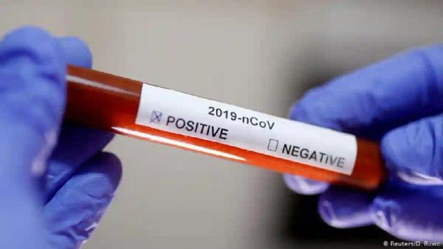 Zimbabwe’s Coronavirus Cases Rise To 36